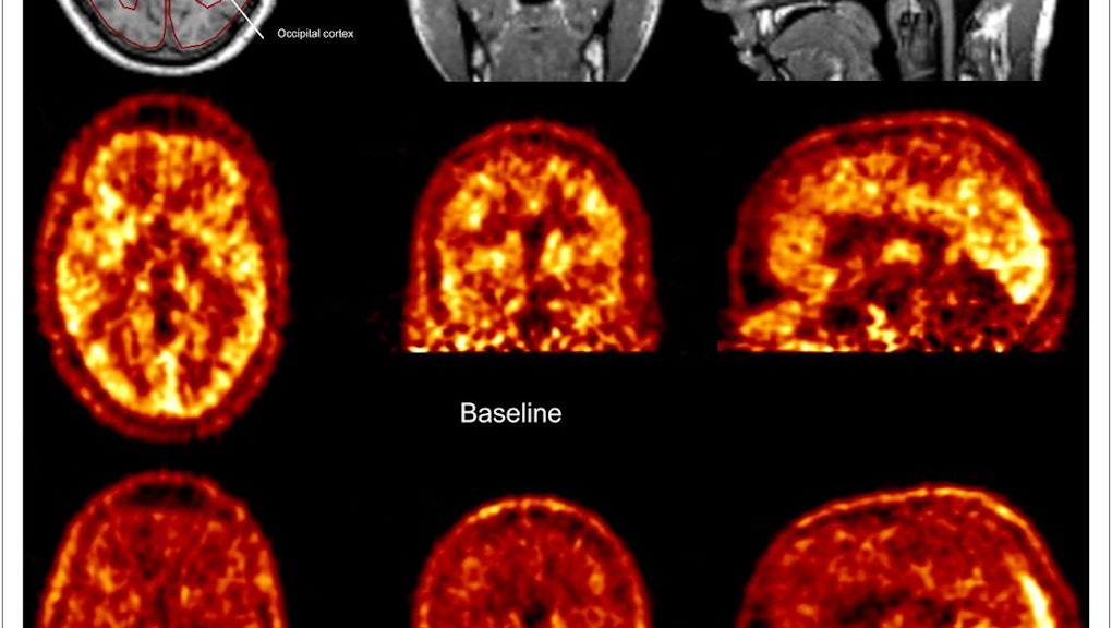 Here S Exactly What Coffee Is Doing To Your Brain coffee is doing to your brain