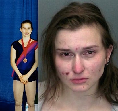Before and after picture of an Ivy League student that is now a heroin addict