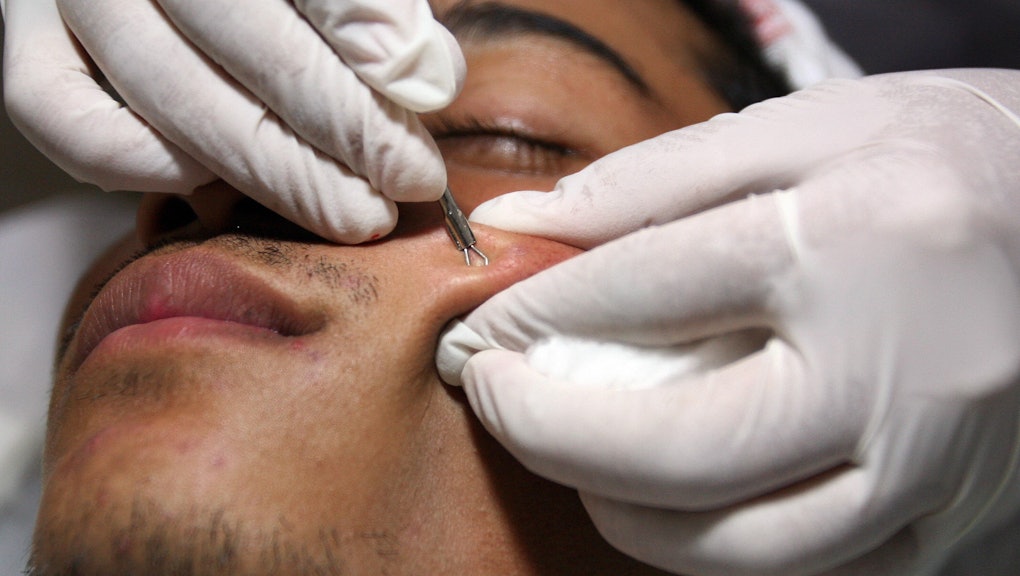 You've Been Popping Pimples Wrong Your Whole Life