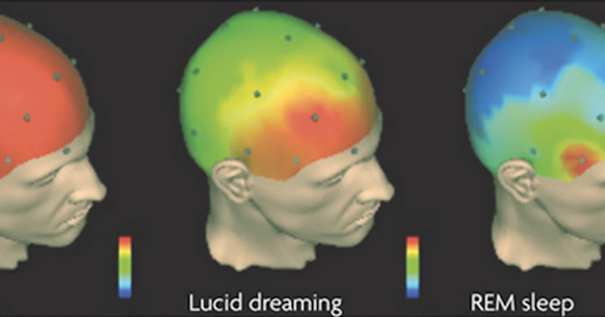 The Fascinating Science of What Dreaming Does to Your Brain