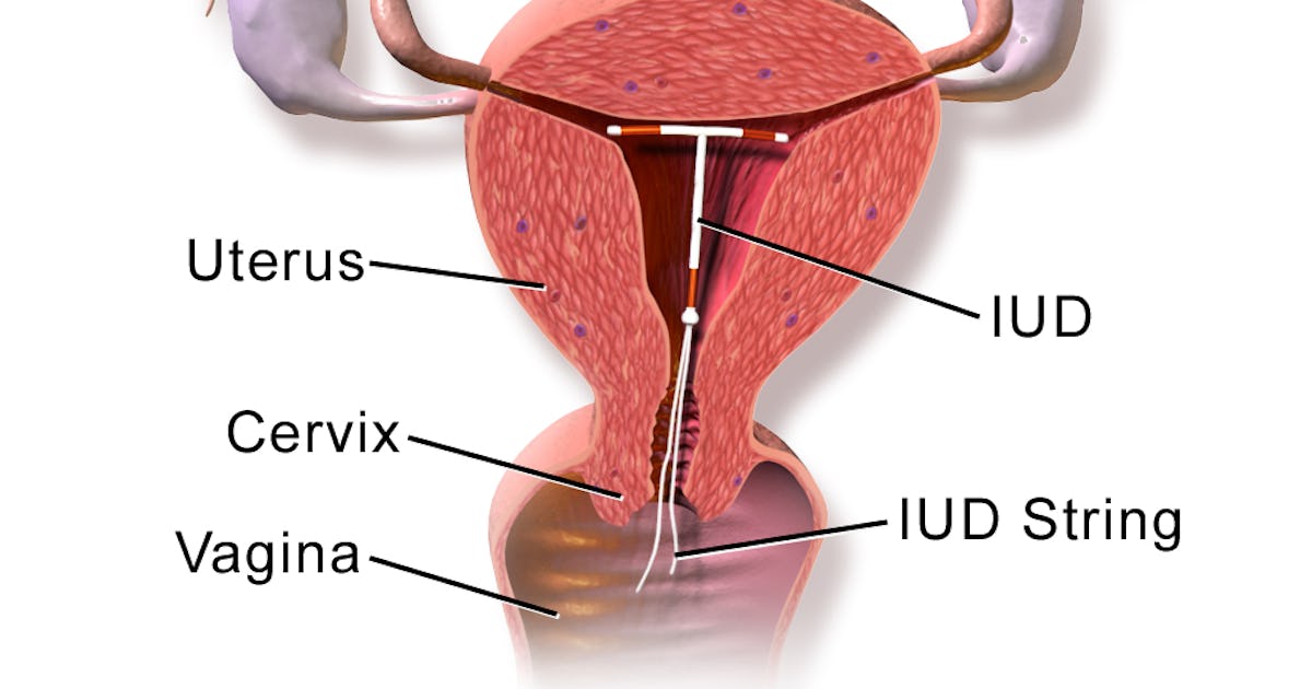 How Do Iuds Work What You Need To Know About The Popular Form Of Birth Control How Do Iuds Work What You Need To Know About The Popular Form Of Birth Control