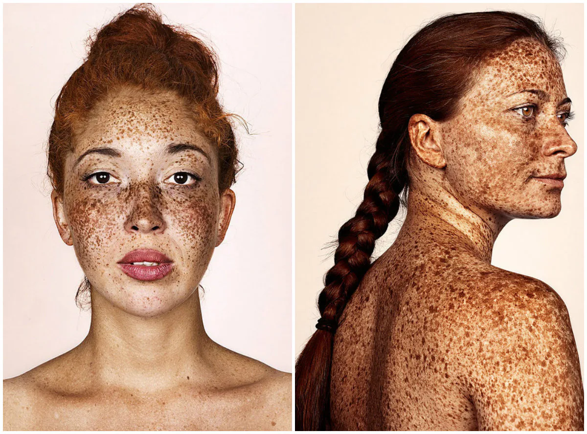 These Portraits Show How Beautifully Mesmerizing Freckles Can Be