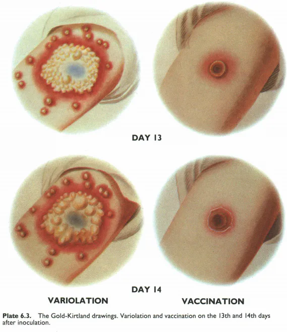 Benjamin Franklin's Son Died of Smallpox. His Notes on Vaccines Matter ...