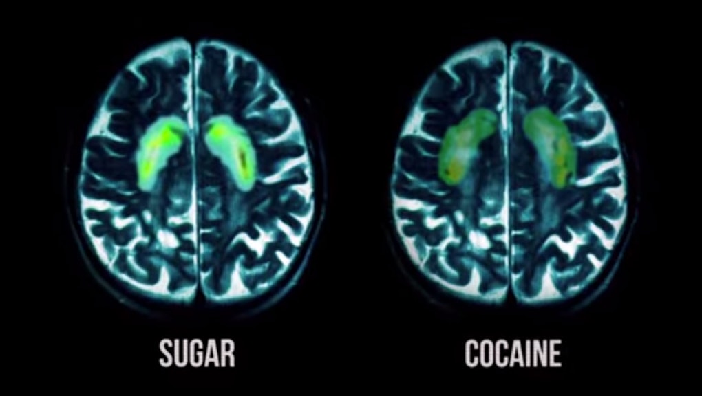 What Happens To Your Brain On Sugar Explained By Science what-happens-to-your-brain-on-sugar-explained-by-science