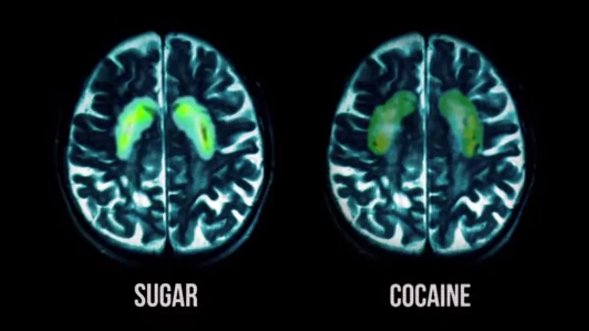 What Happens to Your Brain on Sugar, Explained by Science