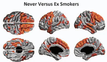 do cigarettes affect your brain Smoking Doesn't Just Hurt Your Body — It Also Hurts Your Brain