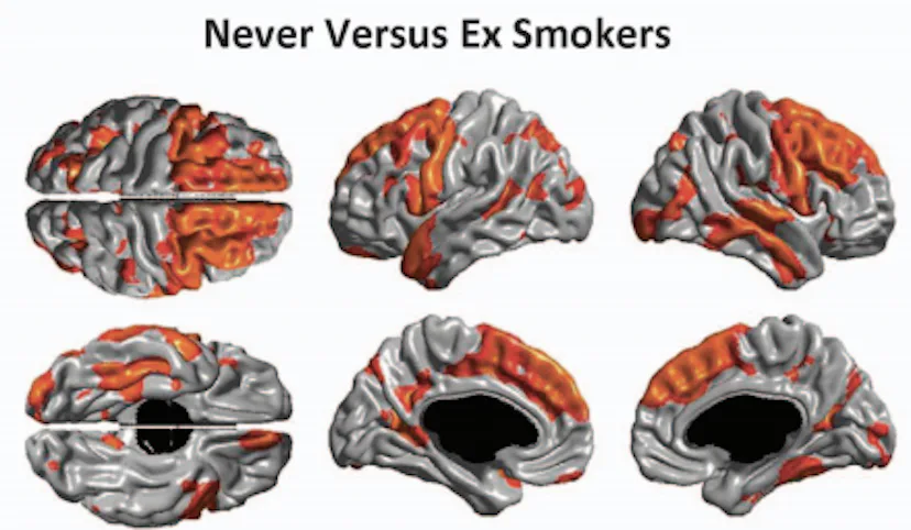 do cigarettes affect your brain Smoking Doesn't Just Hurt Your Body — It Also Hurts Your Brain do cigarettes affect your brain Smoking Doesn't Just Hurt Your Body — It Also Hurts Your Brain