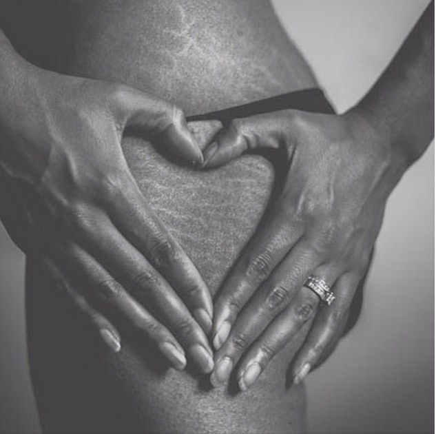A Beautiful Photo Project Is Empowering Women To Embrace Their Stretch Marks