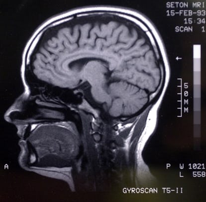 Science Has Discovered There Are Actually Two Kinds of Extroverts ...