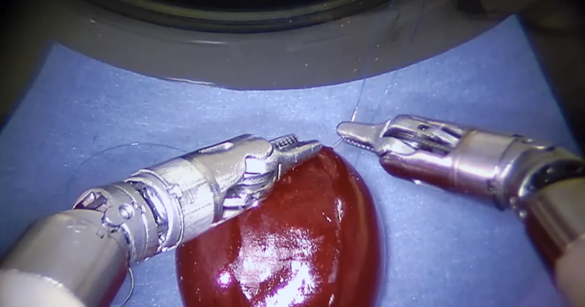 This Advanced Grape-Stitching Robot Could Be the Future of Surgery
