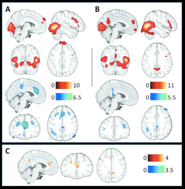 People Who Commit Domestic Violence Have Different Brain Activity Than ...
