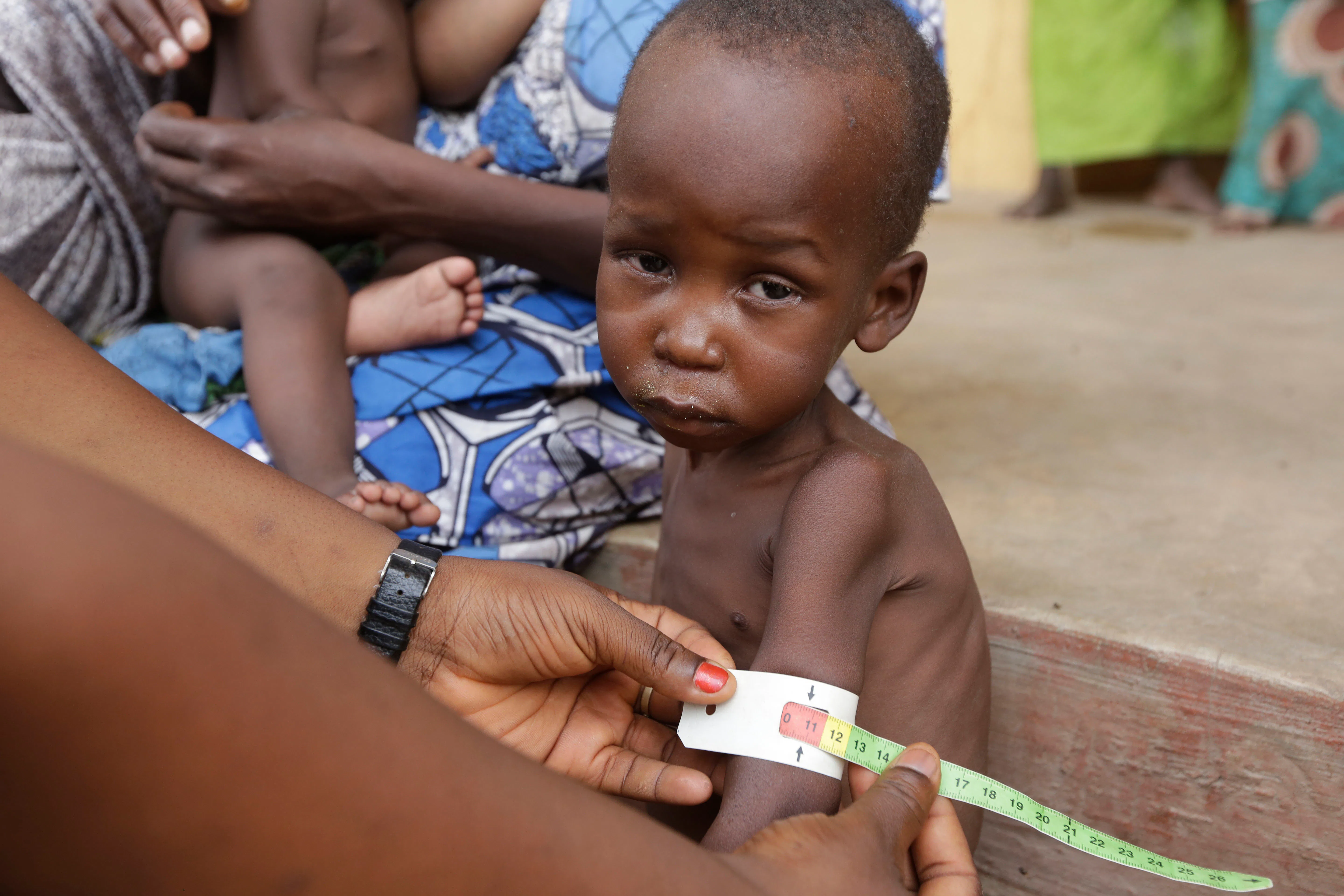 9 Facts About World Hunger That Will Blow Your Mind