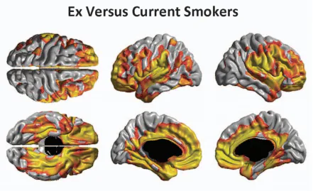 do cigarettes damage your brain Smoking Doesn't Just Hurt Your Body — It Also Hurts Your Brain