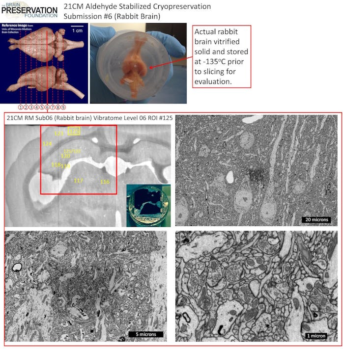 Scientists Have Successfully Preserved an Entire Rabbit Brain for the ...