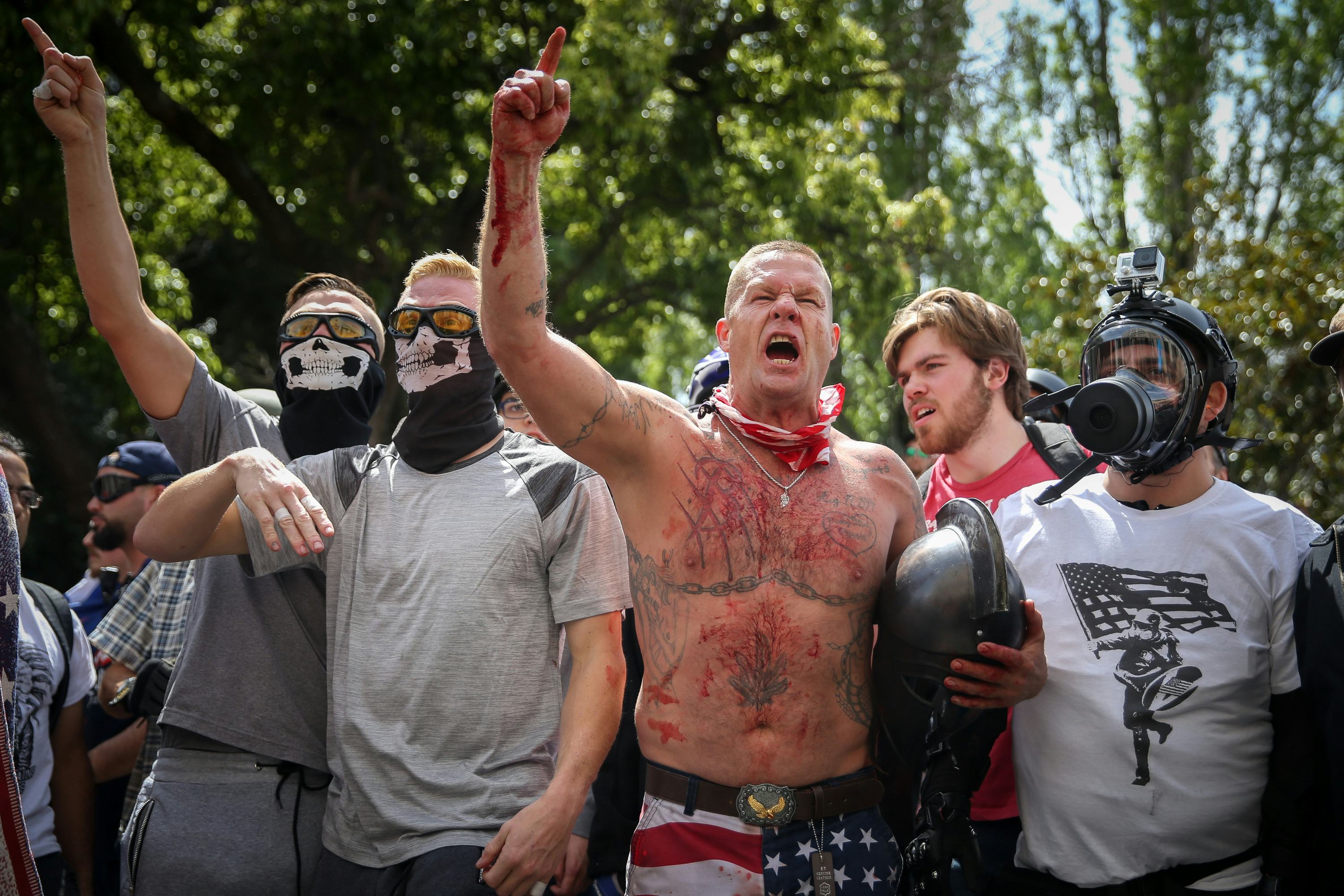 Berkeley brawl protester punched by white supremacist shares her story