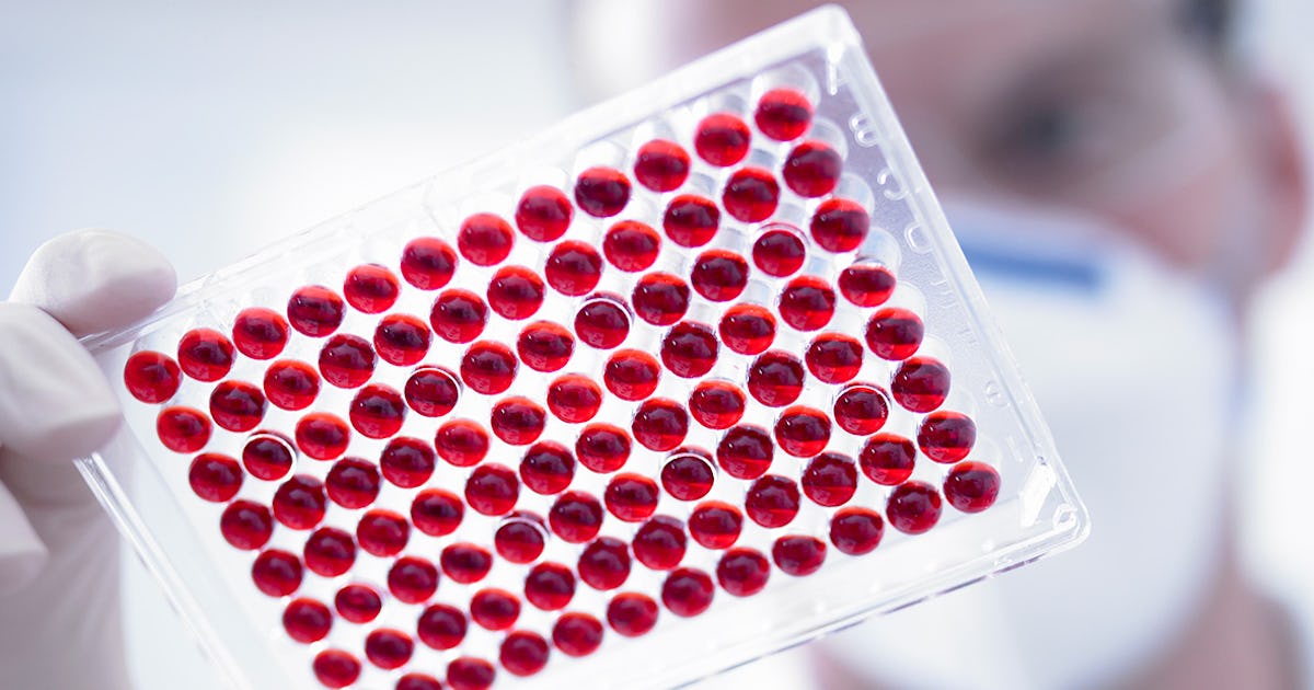 Scientists May Have Found the Key to an HIV Cure