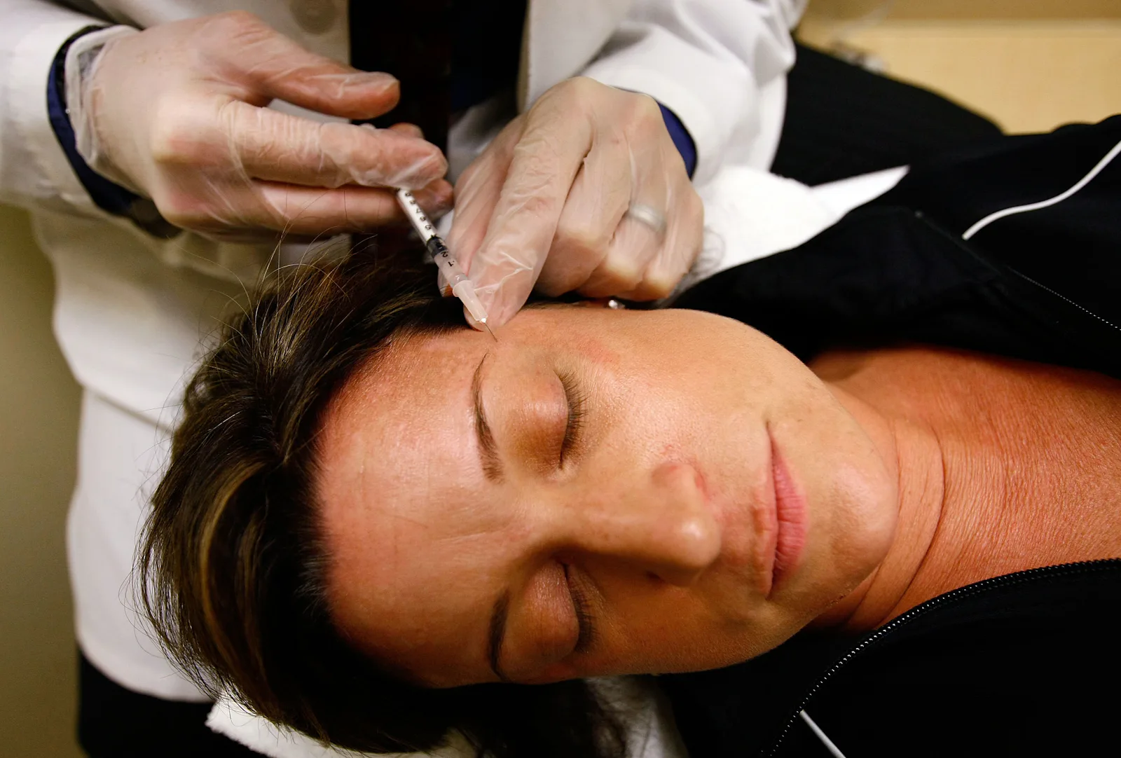 Is Botched Botox Fixable? Sort Of, But Do You Really Want To Take That ...