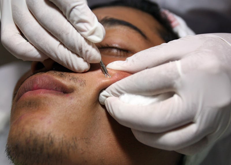 The One Thing You Should Never Do When Popping A Zit