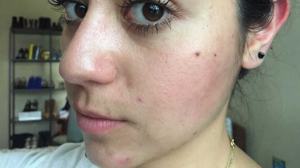 21 Things People With Oily Skin Are Sick Of Hearing