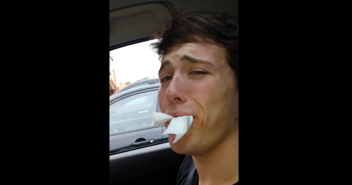 Beyonce Didn't Attend Teen's Wisdom Teeth Removal Surgery, Moved Me To ...