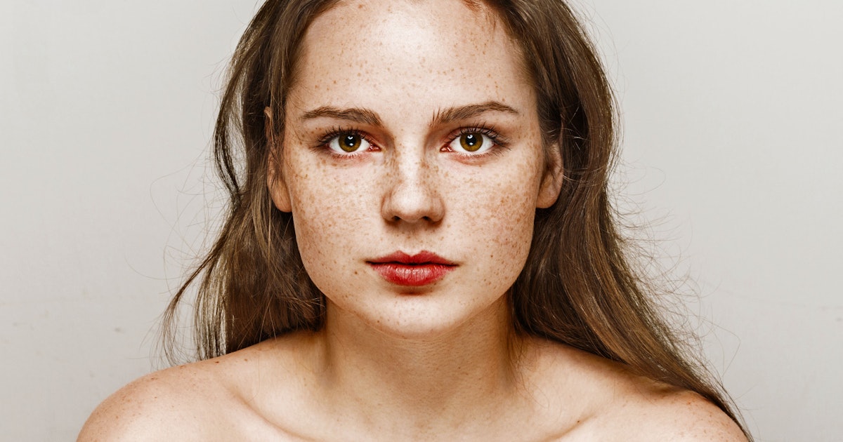 7 Ways To Get Freckles In The Sun Without Putting Yourself At Risk