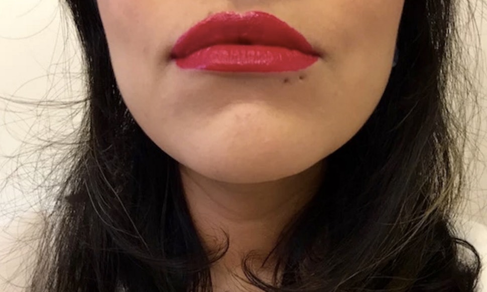 Facelift Case Studies Beverly Hills | Facial Tightening ... What Happens To A Piercing Once It's Removed? Here's What ...