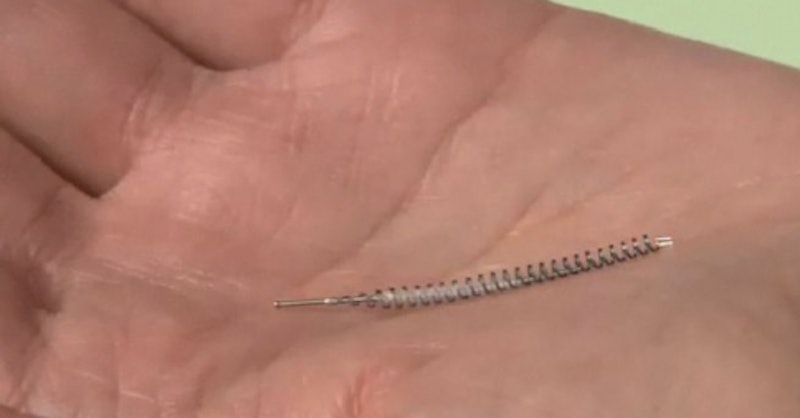 Permanent Birth Control Method Essure has Turned into a Living