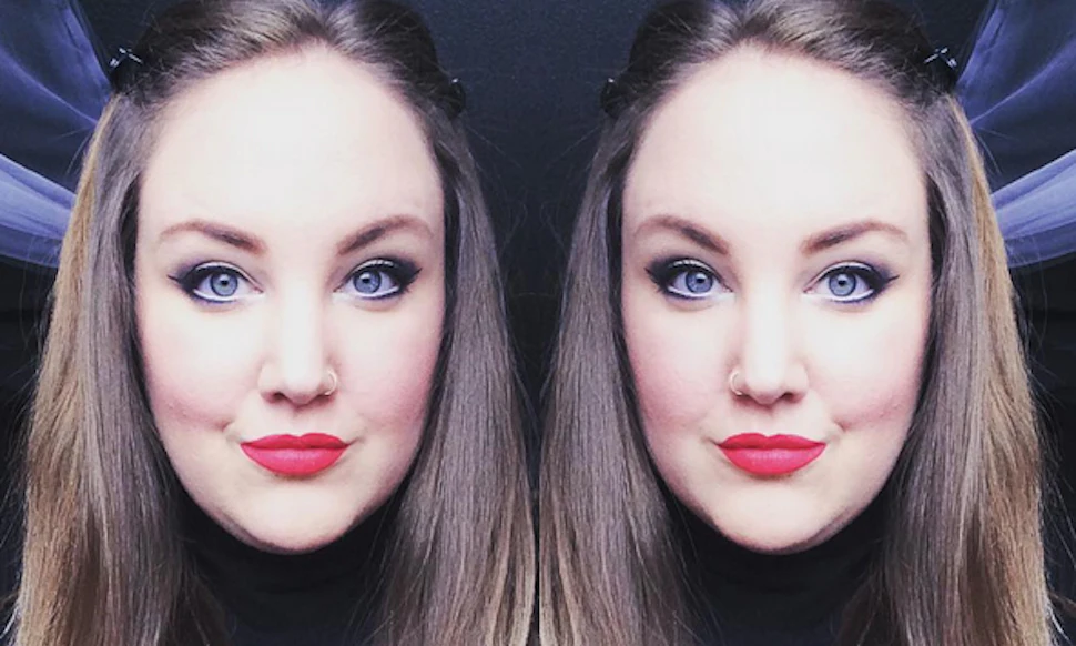 Hug Forehead 32 Photos Of Individuals With Big Foreheads Who Prove That