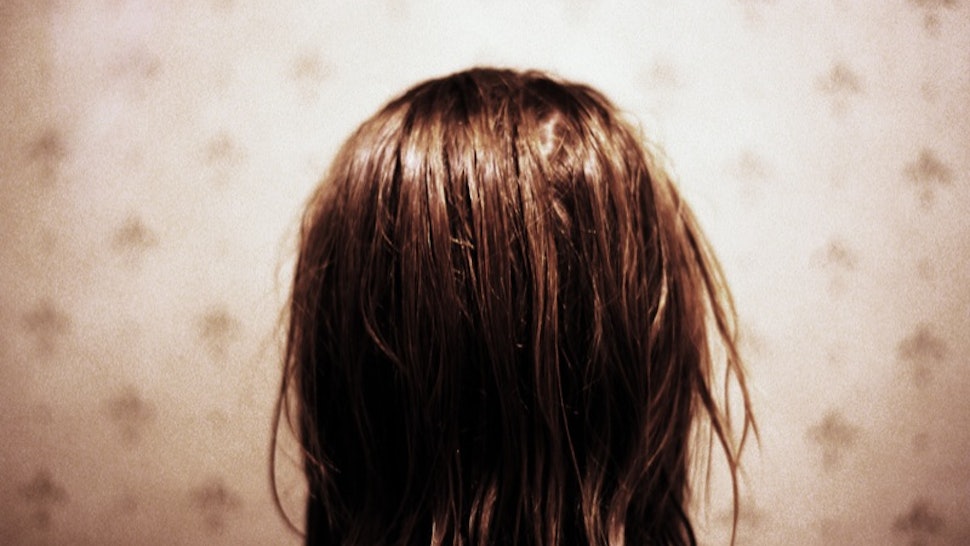 3 Natural Dandruff Treatments You Can Make At Home Anytime Your