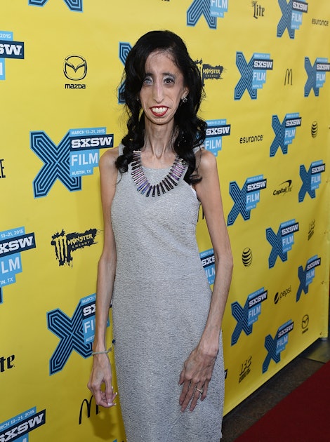 Who Is Lizzie Velasquez Meet The Inspiring Anti Bullying Activist Starring In The Doc A Brave