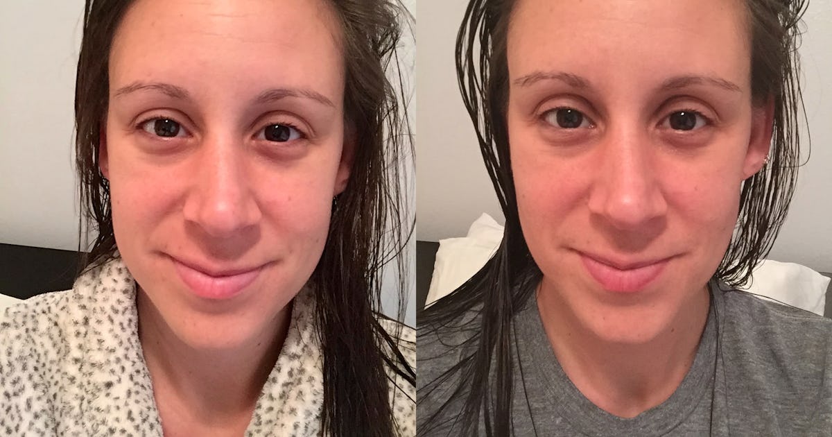 Does Sleeping On A Silk Pillowcase Help Improve Skin Health And