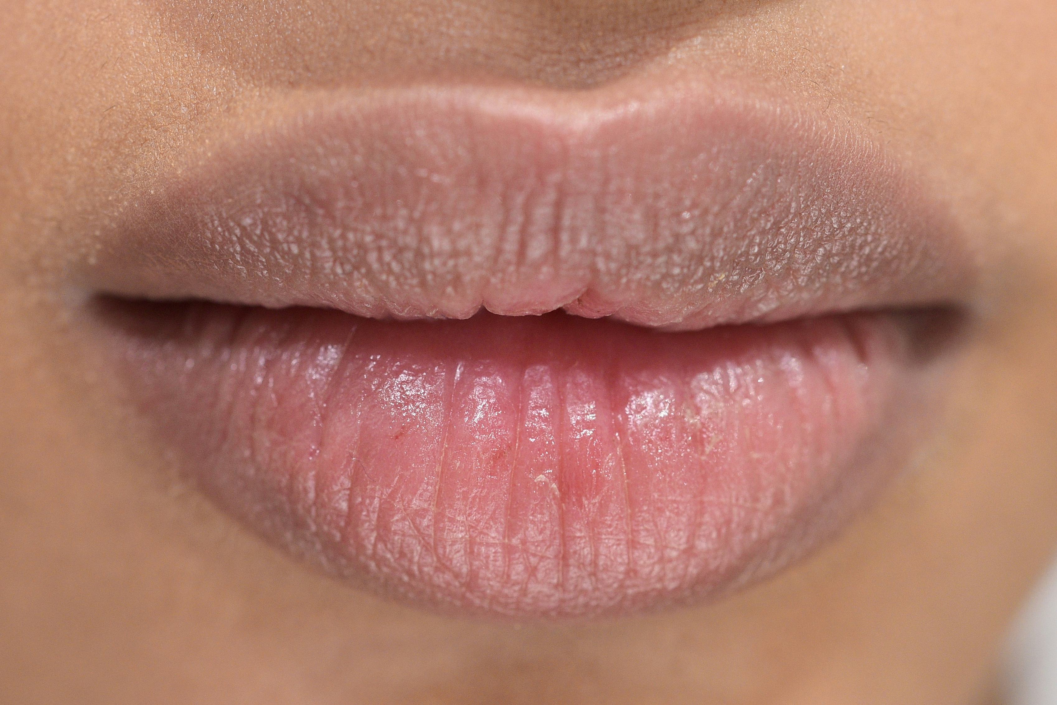The One Solution To Chapped Lips Will Save Your Pout This Windy Season