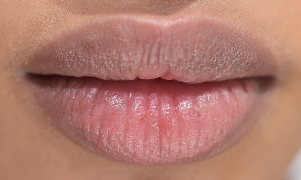 Chapped lip oral sex hiv