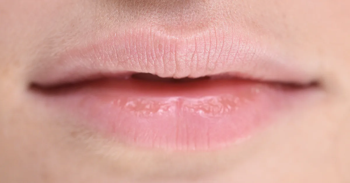 Yapping Lips 9 Ways To Keep Your Lips From Chapping (Or Treat Them When The Wind Has ...