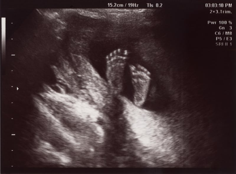 Babies Declared Too Big In Utero Are Often Smaller Than Doctors Predict Study Finds Here S Why That Could Be A Problem Babies Declared Too Big In Utero Are Often Smaller Than Doctors Predict Study Finds Here S Why That Could Be A Problem