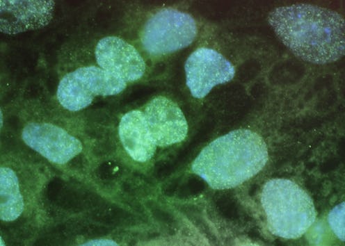 A microscope view of the first stem cell study of bipolar disorder.