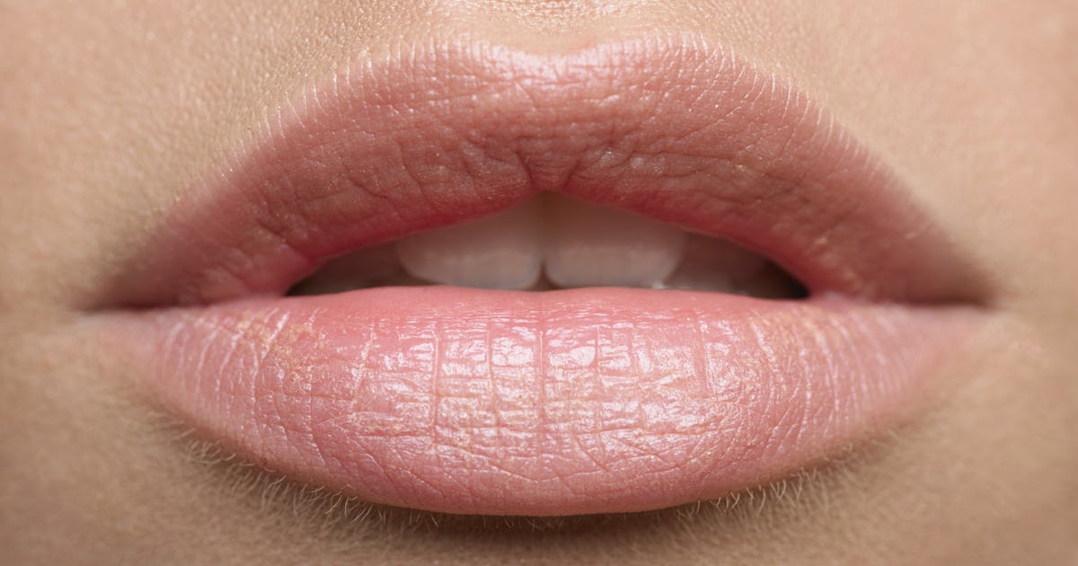 How To Get Rid Of Cold Sore Scars As Quickly As Possible