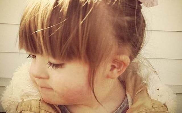 A portrait of a little girl with special needs and disability