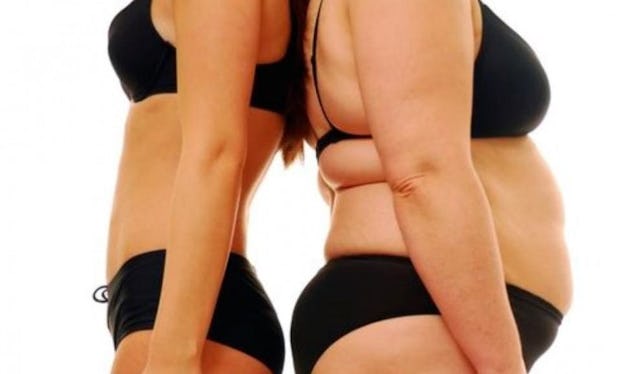 Two female bodies, one that never had a baby on the left and the other one who had a baby on the rig...