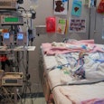 A small baby in a surgery room connected to machines because of a congenital heart defect