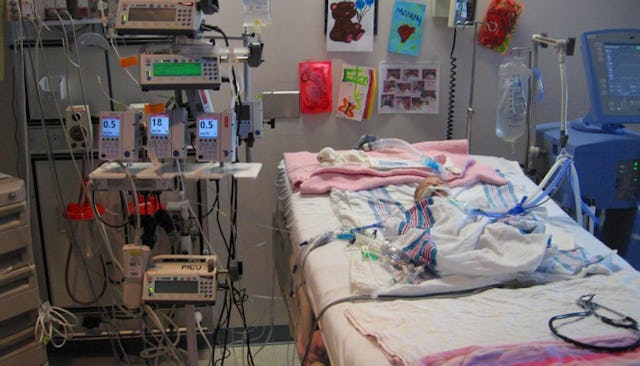 A newborn baby in a surgery room with tubes connected to a device due to a congenital heart defect