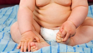 https://imgix.bustle.com/scary-mommy/2015/03/fat-baby.jpg?w=320&h=183&fit=crop&crop=faces&auto=format%2Ccompress