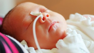 A preemie baby with a breathing tube connected to its nose