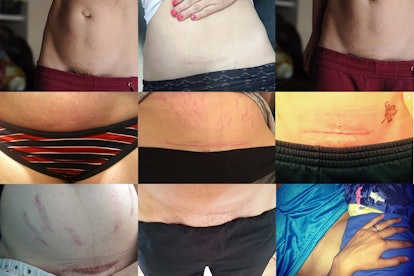 A collage of 9 mama's C-section scars