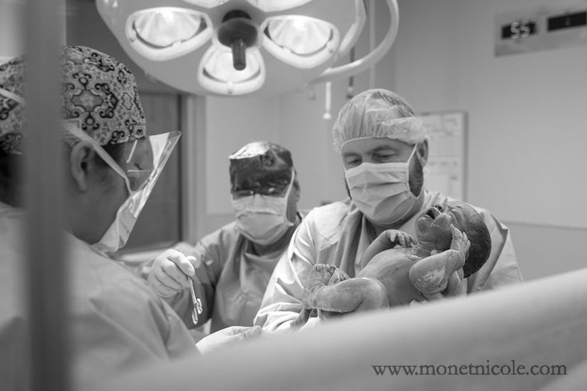A surgeon holding a just born baby after a C-section in black and white