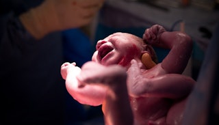 A newborn baby held in arms of a doctor