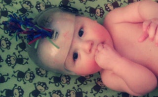 A baby with a see-through helmet on her head and fingers in mouth