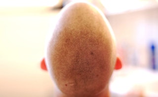 A shaved head of a twelve year old boy