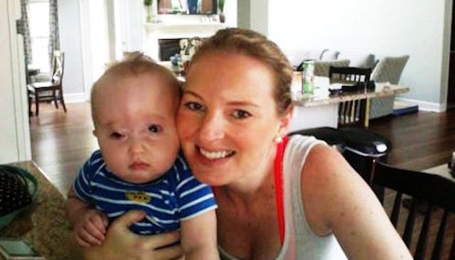 Mother with her baby who people call ugly