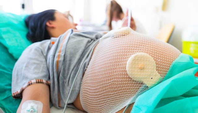 A pregnant woman on the prep table at a hospital before having a VBAC